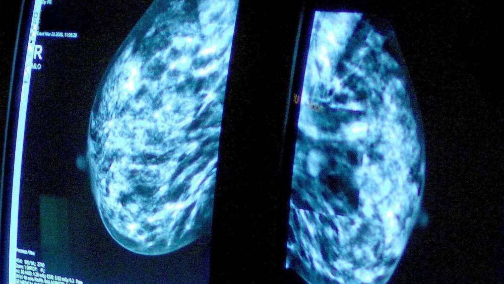 Covid-19 crisis stalls breast screenings, figures show - rte.ie