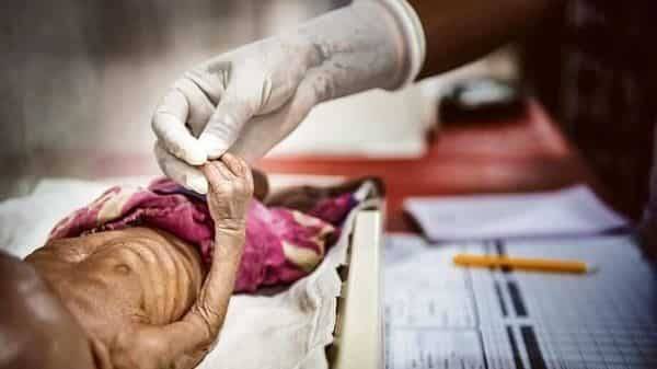 Malnutrition among women, children continues to paralyse healthcare - livemint.com - city New Delhi - India