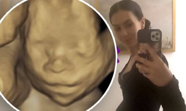 Alec Baldwin - Hilaria Baldwin - Hilaria Baldwin's son confuses her 3D sonogram with 'a statue' - dailymail.co.uk