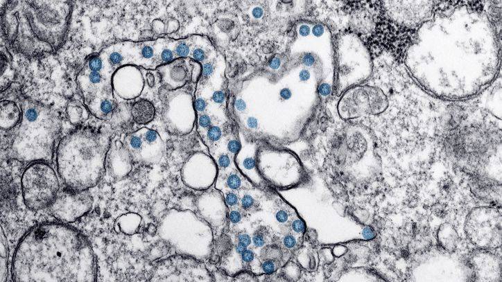 New coronavirus test is imperfect step toward mass screening - fox29.com - Usa - Washington