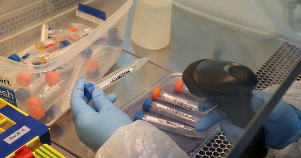 Boris Johnson - New coronavirus antibody test is '100 per cent accurate' say health officials - manchestereveningnews.co.uk - Switzerland