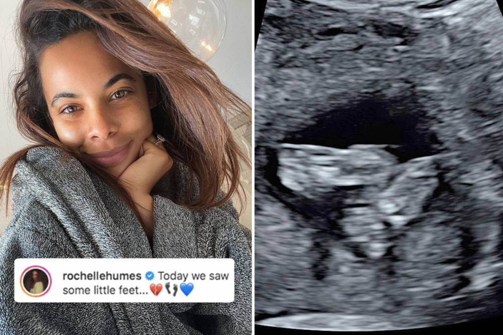 Holly Willoughby - Amanda Holden - Marvin Humes - Rochelle Humes - Rochelle Humes reveals joy at latest baby scan after struggling with morning sickness - thesun.co.uk