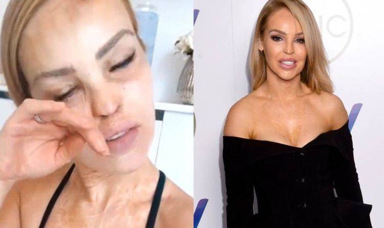 Katie Piper - Katie Piper suffers nasty head injury and is inundated with support while in lockdown - express.co.uk