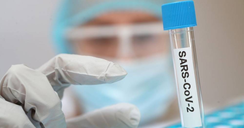 UK coronavirus death toll rises by 384 - manchestereveningnews.co.uk - Britain