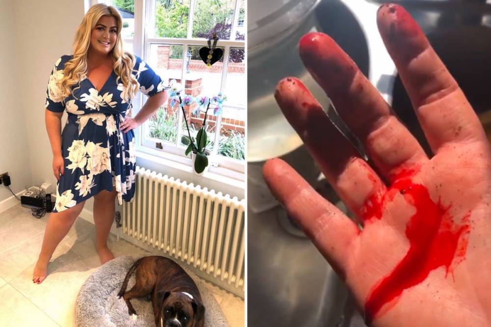 Gemma Collins - Gemma Collins’ hand gushes with blood as she slices finger open in DIY disaster - thesun.co.uk