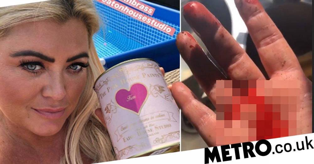 Gemma Collins - Gemma Collins reveals gruesome cut on finger after attempting to sand down garden bench: ‘I’ve got an emergency’ - metro.co.uk
