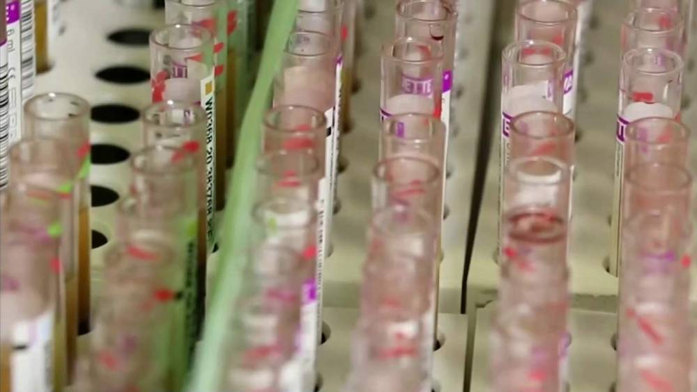 OneBlood to begin testing all donations for coronavirus antibodies - clickorlando.com - state Florida