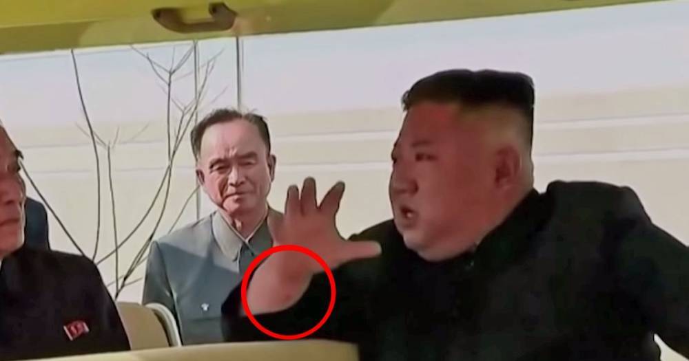 Kim Jong Un - Kim Il 51 (51) - Kim Jong Un seen with mysterious mark on wrist during his first appearance in weeks - mirror.co.uk - Usa - North Korea