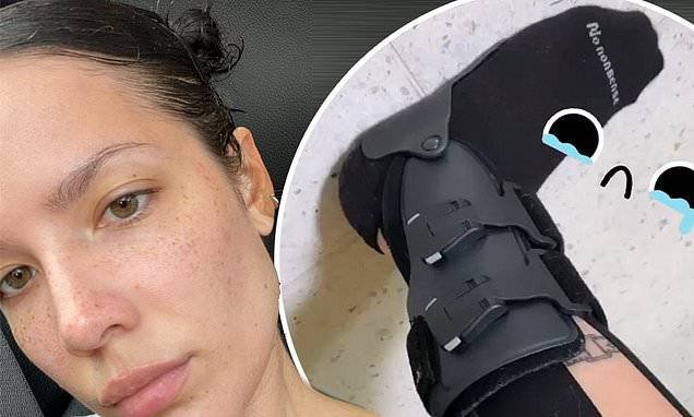 Halsey shows off her freckles in a selfie... after showing off medical boot following foot injury - dailymail.co.uk