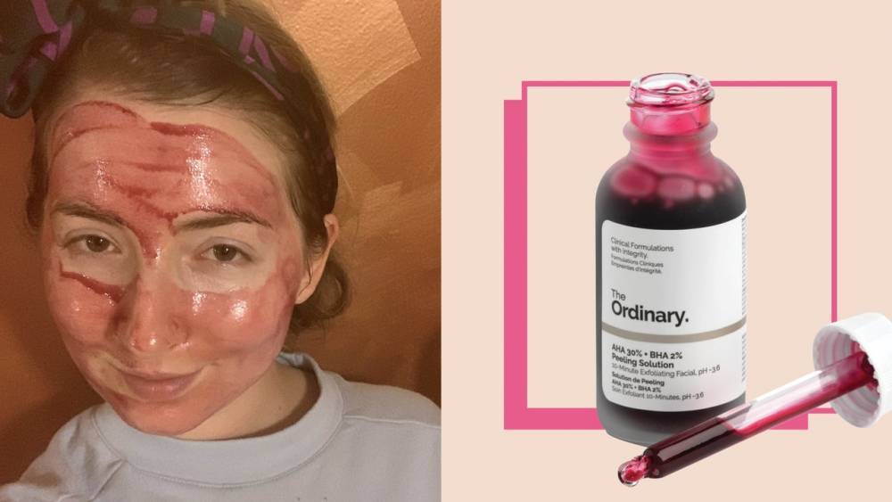 Gwyneth Paltrow - The Ordinary Peeling Solution Review: Why It's Worth It - glamour.com