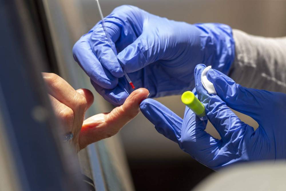US begins crackdown on unvetted virus blood tests - clickorlando.com - Usa - Washington
