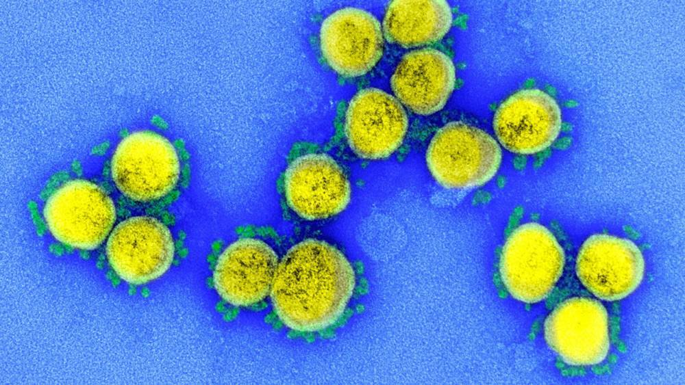 Robert F.Servicescience - Coronavirus antigen tests: quick and cheap, but too often wrong? - sciencemag.org - Usa
