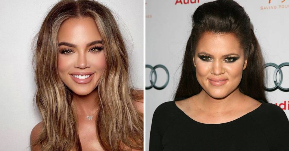 Khloe Kardashian - Kim Kardashian - Khloe Kardashian transformation: Expert says there are ‘tell-tale signs’ of surgery as fans claim star has ‘entire new face’ - ok.co.uk