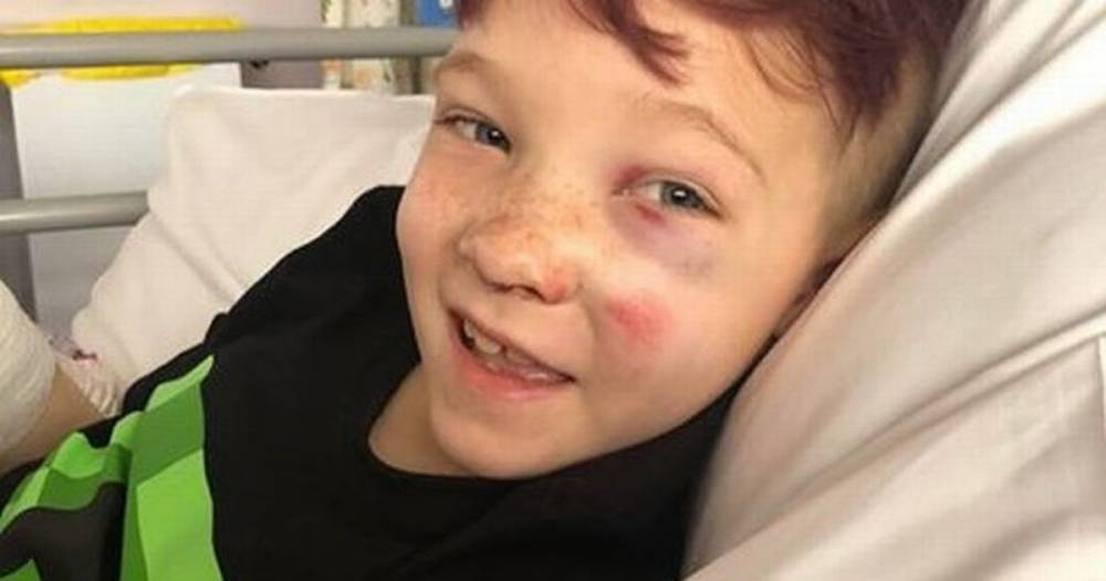 'Warrior' gymnast, 9, bravely keeps smiling despite horror crash seeing leg amputated - dailystar.co.uk