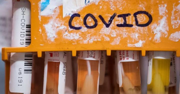 20 new coronavirus cases in Saskatchewan, total rises to 487 - globalnews.ca