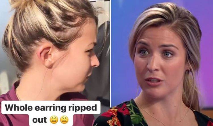 Gemma Atkinson - Gemma Atkinson explains blood on her ear after incident during outing ‘Not Nice!’ - express.co.uk