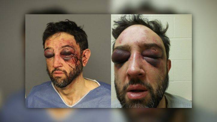 Bodycams captured man’s arrest; now Denver PD faces excessive force lawsuit - fox29.com