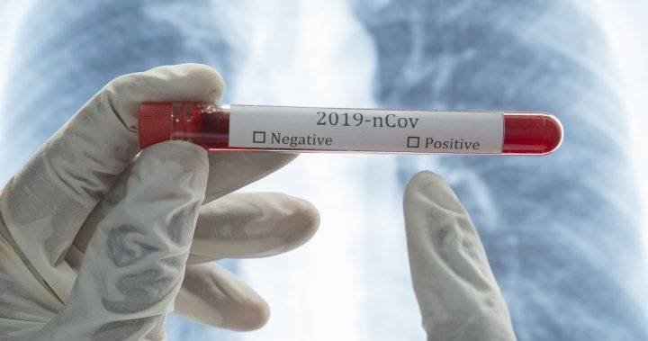1 new coronavirus case in Saskatchewan, 6 more recoveries - globalnews.ca