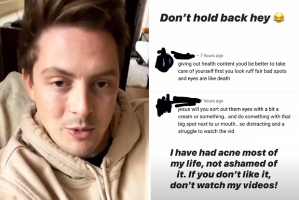 Alex George - Dr Alex George horrified as troll mocks his acne and say he ‘looks like death’ after working long shifts in A&E - thesun.co.uk