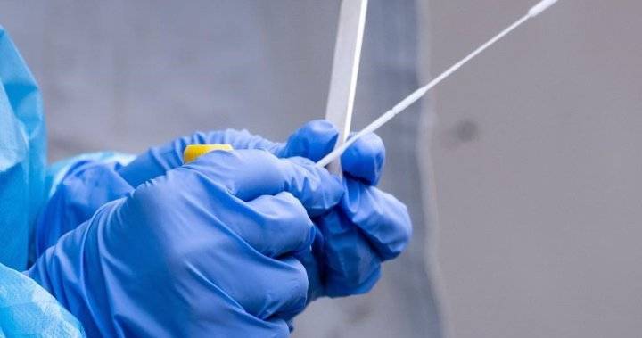Hiawatha I (I) - Lake I (I) - Peterborough Public Health - Coronavirus: Peterborough cases remain at 91, Northumberland County reports 1 new case - globalnews.ca - county Northumberland - city Peterborough