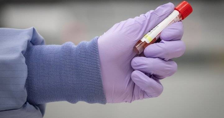 Alberta Health - Deena Hinshaw - Alberta Coronavirus - Coronavirus: 2 previous deaths ruled not virus related as Alberta records 40 more cases Thursday - globalnews.ca