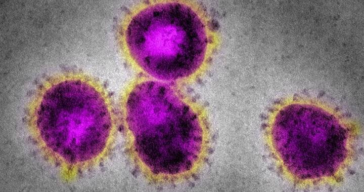 Two more coronavirus cases confirmed in Manitoba Tuesday - globalnews.ca