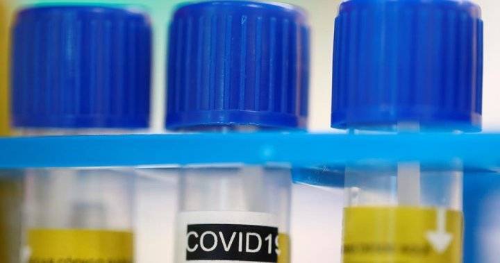 One new coronavirus case in Saskatchewan, no new recoveries, health officials say - globalnews.ca