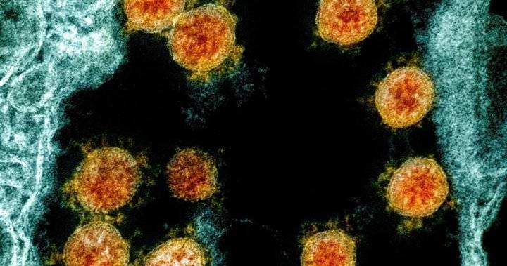 Saskatchewan reports 1 new coronavirus case, 3 more recoveries - globalnews.ca