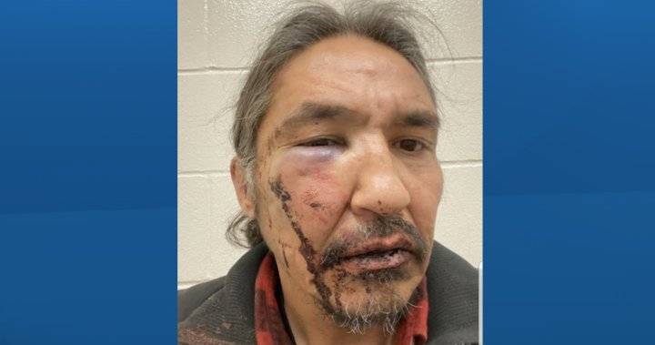 Alberta - Allan Adam - Northern Alberta First Nations chief alleges he was beaten by RCMP - globalnews.ca