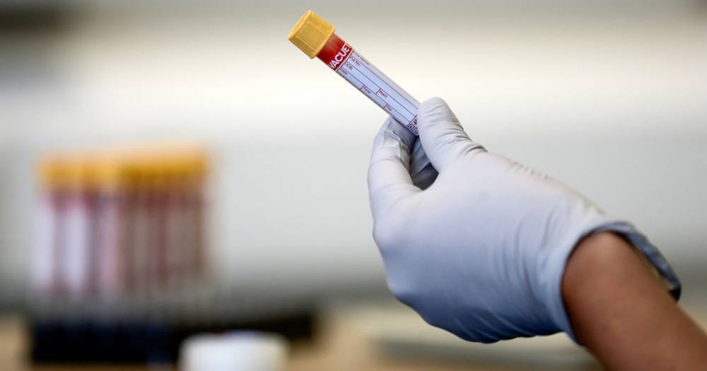 UK coronavirus death toll rises by 77 - manchestereveningnews.co.uk - Britain - city Manchester