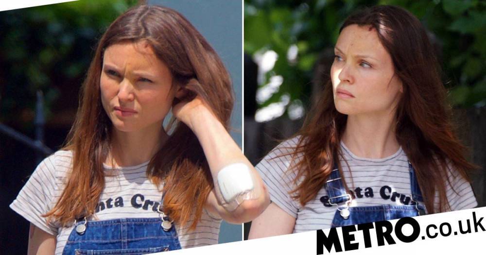 Richard Jones - Sophie Ellis-Bextor proves she’s on the mend as she heads out with her elbow all patched up after nasty bike accident - metro.co.uk