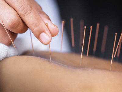 Acupuncture before surgery may reduce pain, opioid use - medicalnewstoday.com
