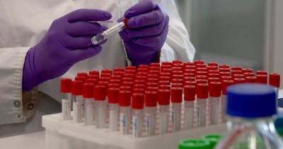 Johnson & Johnson pauses coronavirus vaccine trials after ‘unexplained illness’ - globalnews.ca