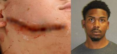 Arrest made in random face-slashing attack that left teen injured in Orange City - clickorlando.com - state Florida - county Orange - city Orange, state Florida