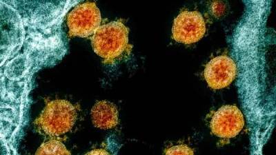 Scientists develop new method to block coronavirus replication - livemint.com - Usa - state Texas - city San Antonio - city Houston