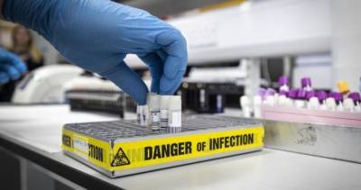 Christine Elliott - Ontario reports new record of 797 coronavirus cases, nearly 48.5K tests processed - globalnews.ca - Canada - county Ontario - city Ottawa - county York - region Halton