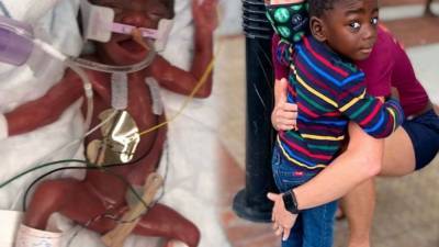 Graduation parade marks milestone for Georgia 'miracle baby' - fox29.com - Georgia