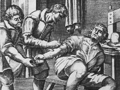 Bloodletting: Why doctors used to bleed their patients for health - medicalnewstoday.com - Greece - Egypt