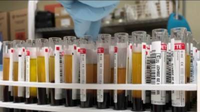 Blood shortages still a problem as COVID-19 pandemic surges - foxnews.com - Usa - county Cross