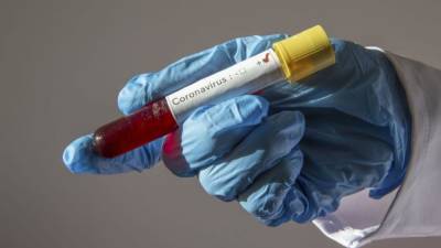 Coronavirus cases in US may be 8 times higher than previously reported, CDC warns - fox29.com - Usa