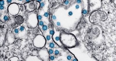 Interior Health - Coronavirus: Nearly 50 new cases announced for Interior Health region - globalnews.ca - region Health