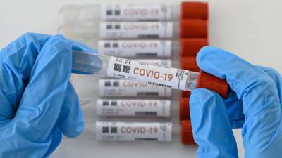 Experts predict COVID-19 numbers may be misleading after the holiday - fox29.com - city Milwaukee