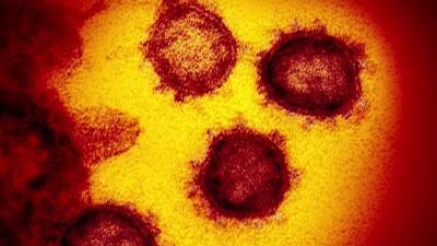 Pennsylvania sets daily high in COVID-19 cases with 3,384 reported infections - fox29.com - state Pennsylvania