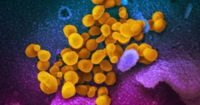 Coronavirus: Hamilton reports 47 new COVID-19 cases, 2 deaths - globalnews.ca - county Ontario - city Elizabeth, county Richardson - county Richardson