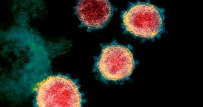 New Brunswick - New Brunswick reports 2 new coronavirus cases Sunday - globalnews.ca - region Fredericton