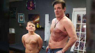 Dad gets huge tattoo identical to son’s birthmark on his chest - fox29.com - Canada