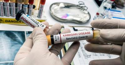 The Kawasaki-like illness linked to coronavirus affecting children - everything you need to know - dailyrecord.co.uk