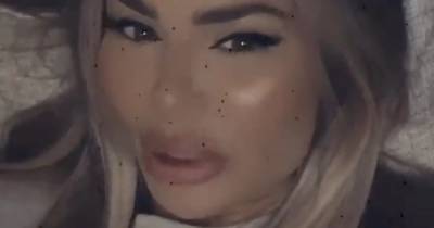 Chloe Sims - Chloe Sims furiously slams trolls who claim star has had 'too much surgery' and 'can't move her face' - ok.co.uk