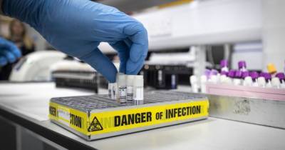 Coronavirus Scotland: 38 confirmed dead as almost 1,000 new cases announced - dailyrecord.co.uk