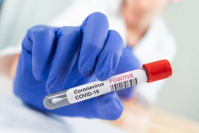 'Tidal wave' of coronavirus cases in Alabama could soon overrun state’s hospitals, warns official - foxnews.com